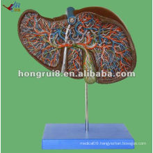 Vivid Liver Anatomical Model with gall bladder model,Liver Anatomical Model